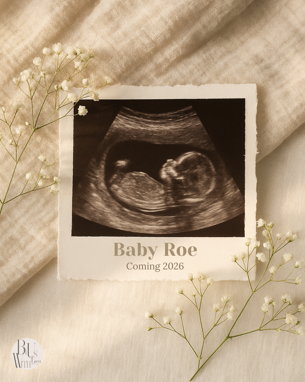 Pregnancy Announcement Digital Download – Gender Neutral Ultrasound Canva Template